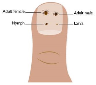 Illustration of a finger nail with ticks of various ages on it 