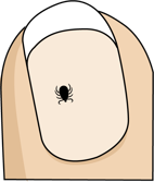 Illustration of an unfed tick on a human fingernail to show scale.